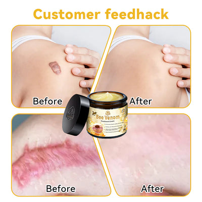 Lovilds™ Bee Venom Skin Treatment Cream（𝐴𝐴𝐷 𝑅𝑒𝑐𝑜𝑚𝑚𝑒𝑛𝑑𝑒𝑑