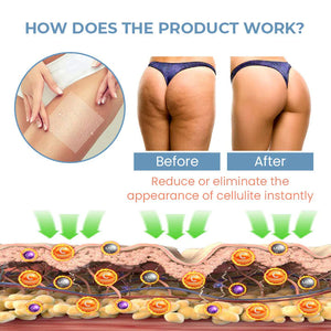 Oveallgo™ PRO TightenCell Anti-Cellulite Collagen Firming Patches