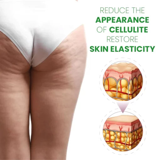 Best Cellulite Treatment Balm |Cellulite Soothing Balm| Deep Cleansing