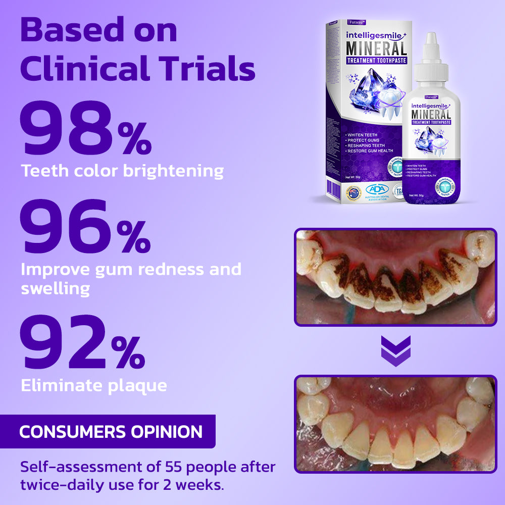 🥇 Furzero™ IntelligeSmile Mineral Treatment Toothpaste (🇦🇺 ADA Recommended)