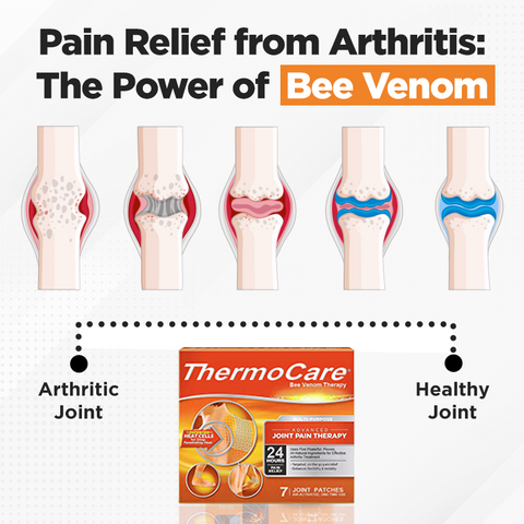 ThermoCare™ Bee Venom Joint and Bone Therapy Patch - Full Body Recovery