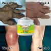 Arthritis Pain Relief Cream | Joint & Bone Therapy | Deep Cleansing