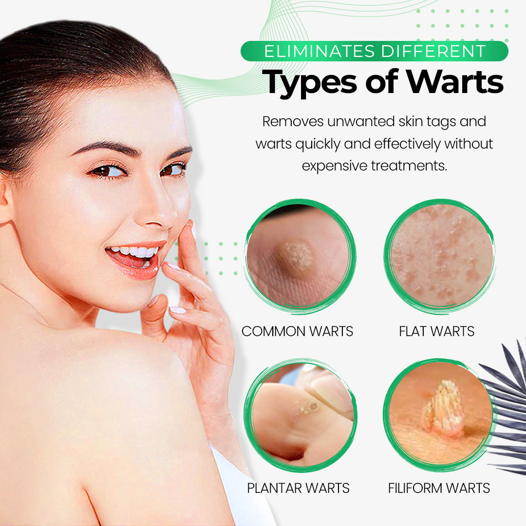 Best Wart Remover Soap | Wart Eliminator Soap | Deep Cleansing