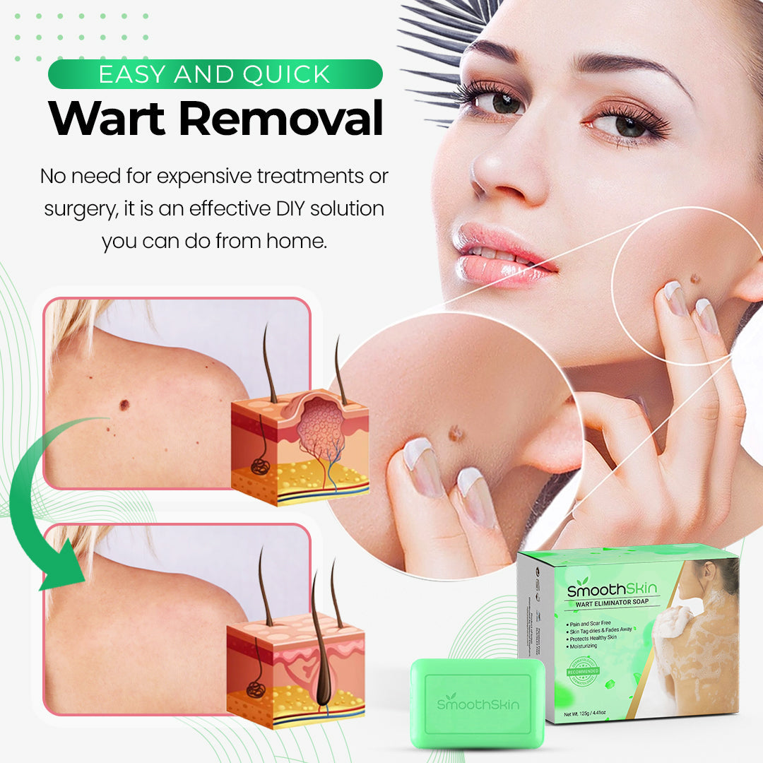 Best Wart Remover Soap | Wart Eliminator Soap | Deep Cleansing