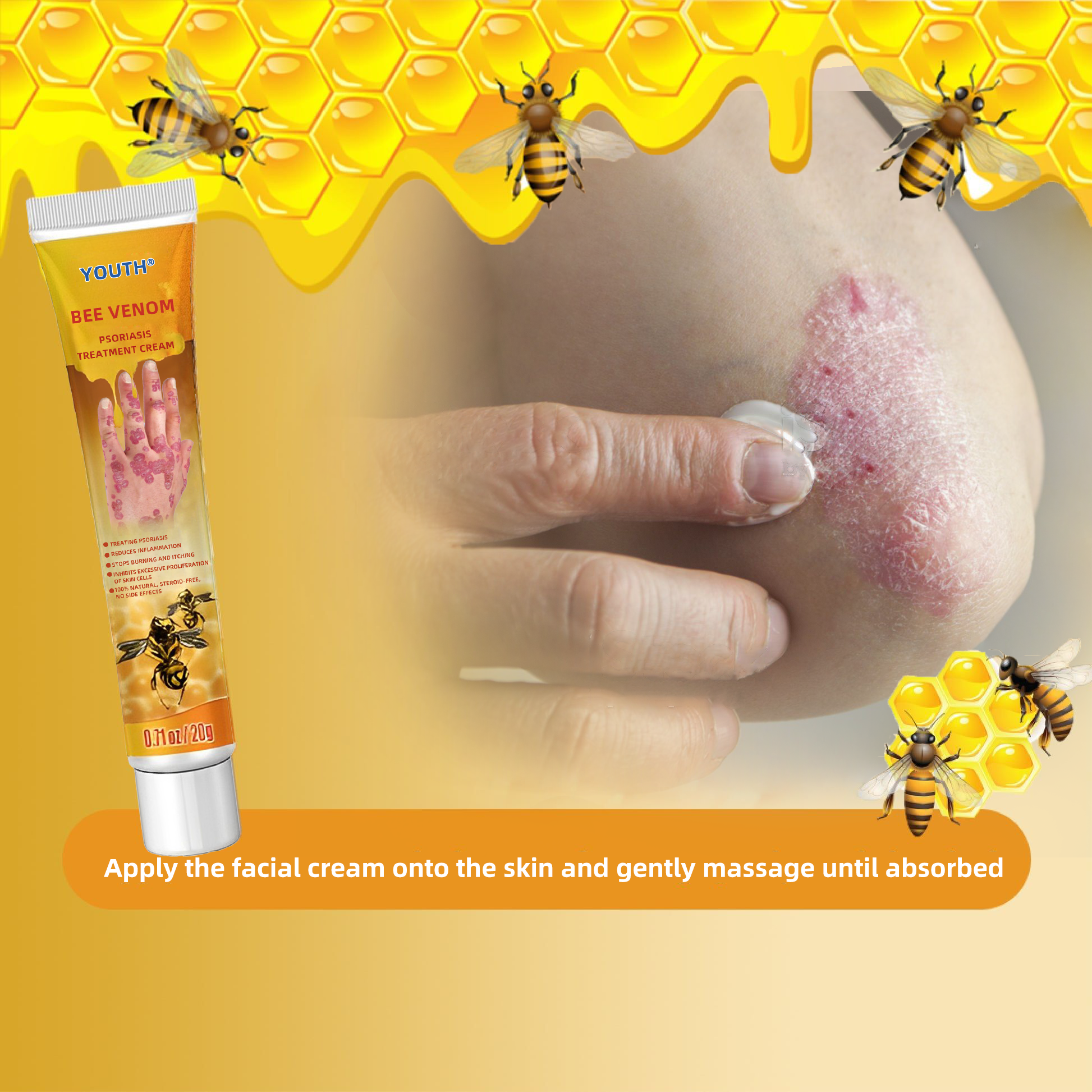 Youth® Bees Venom Psoriasis Treatment Cream