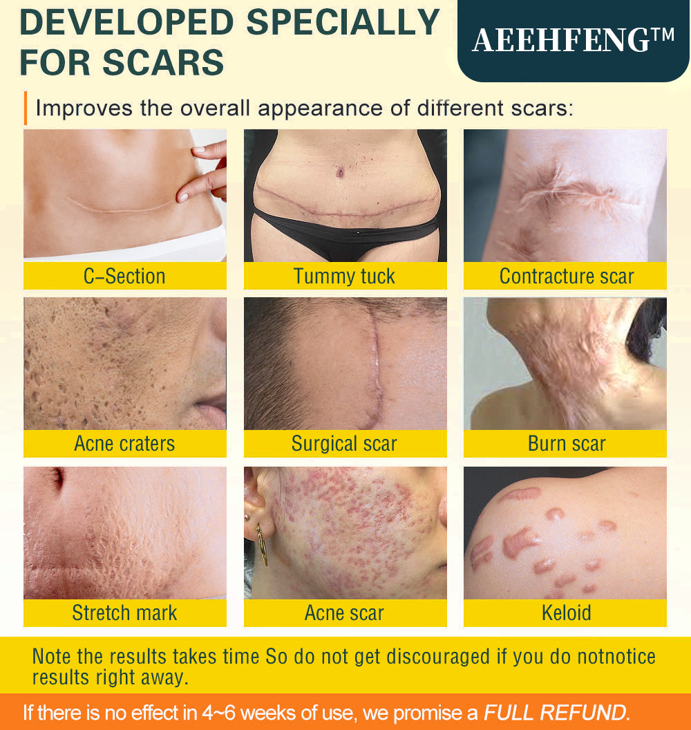 AEEHFENG™Advanced Scar Serum