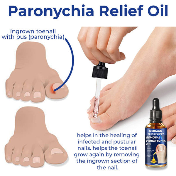 Anti Paronychia Relief Oil | German Toenail Care | Deep Cleansing