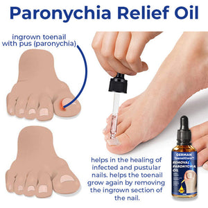 Anti Paronychia Relief Oil | German Toenail Care | Deep Cleansing