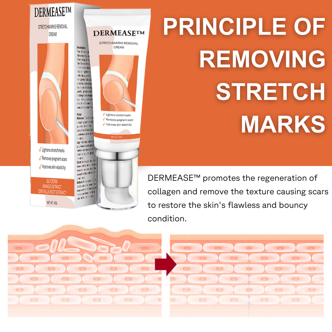 CC™ Stretchmarks Removal Cream