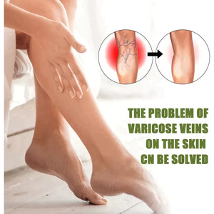 Oveallgo™ Varicose Veins Spray