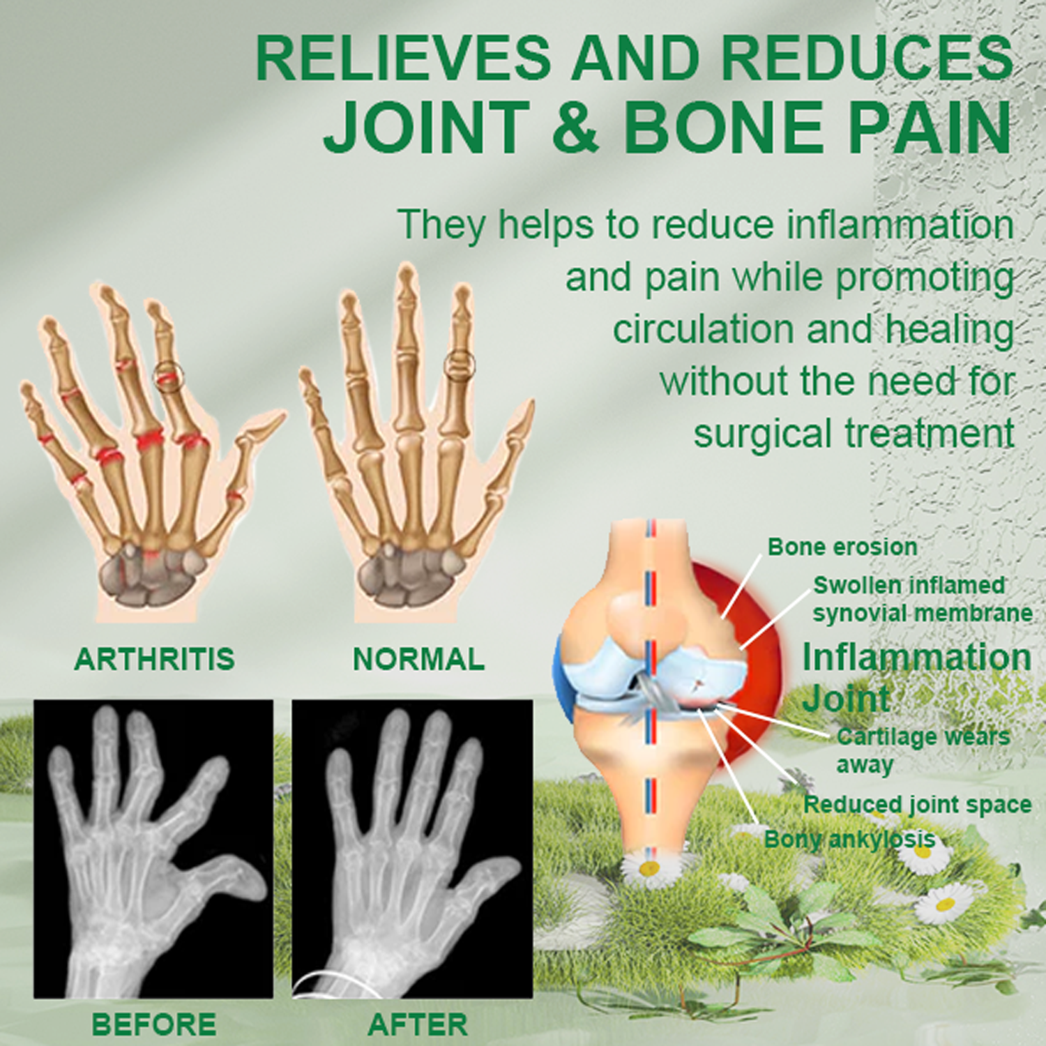 Arthritis Pain Relief Cream | Joint & Bone Therapy | Deep Cleansing