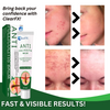 ClearFX™ Anti-Folliculitis Balm