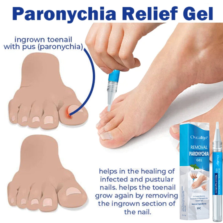 CC™ Removal Paronychia Gel