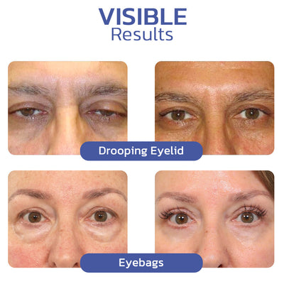 Eyelid Lift Cream | Lifting Eyelid Defining Cream | Deep Cleansing