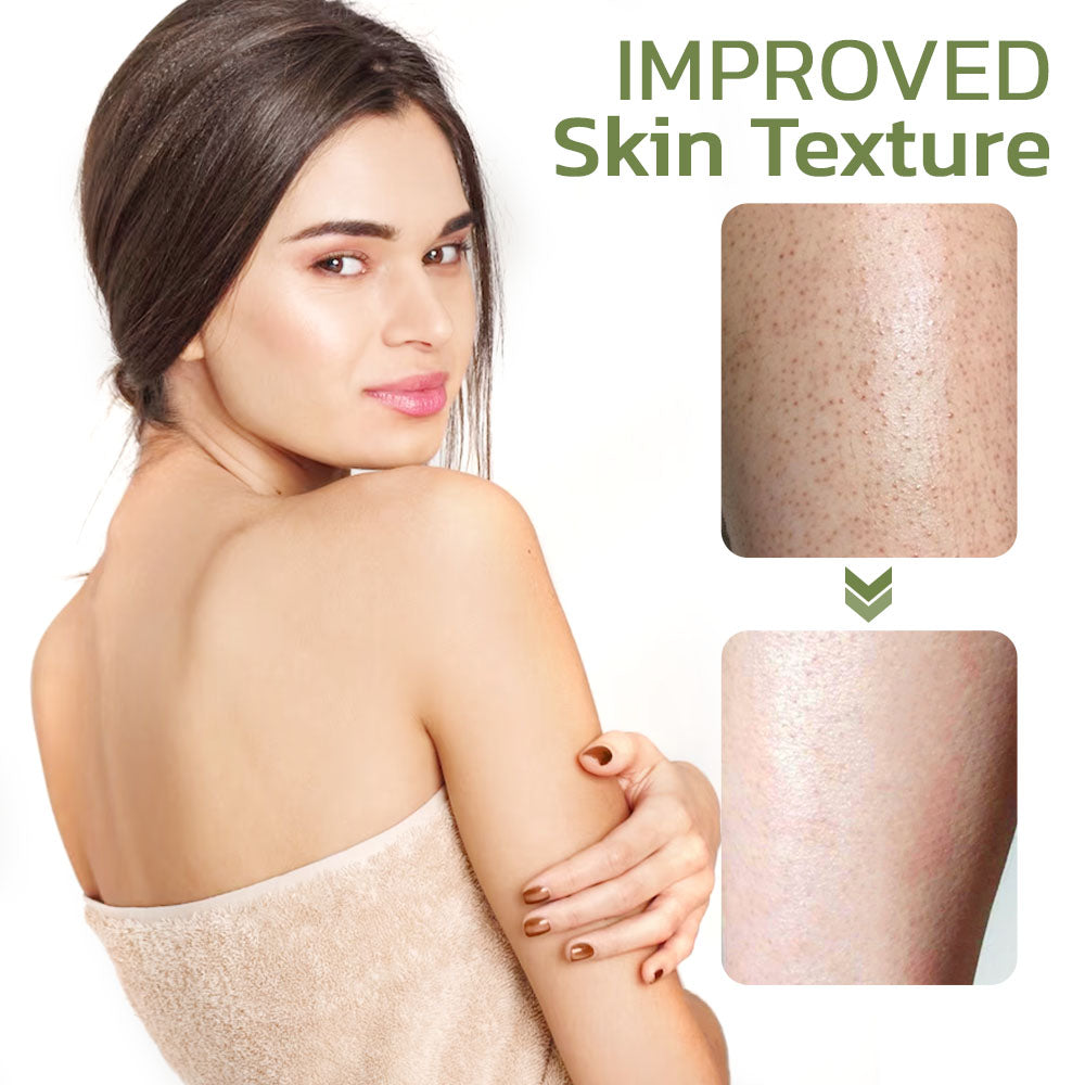 Keratosis Pilaris Cream | Deep Clean Smooth Cream | Deep Cleansing