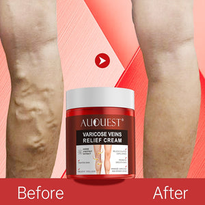 AUQUEST Varicose Veins Relief Cream