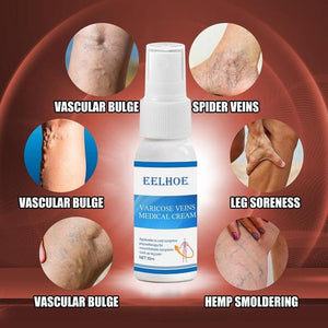 Varicose Veins Cream | Varicose Veins Treatment Spray | Deep Cleansing