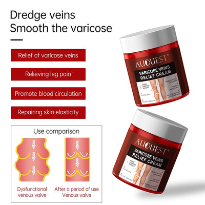 Varicose Vein Treatment Cream | Varicose Relief Cream | Deep Cleansing