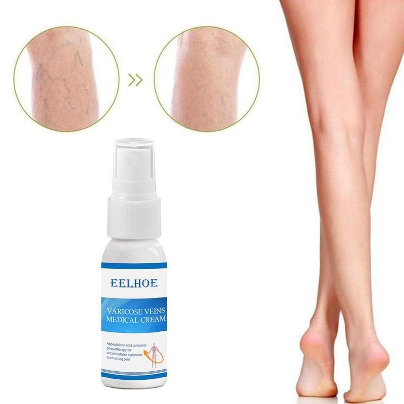 Varicose Veins Cream | Varicose Veins Treatment Spray | Deep Cleansing