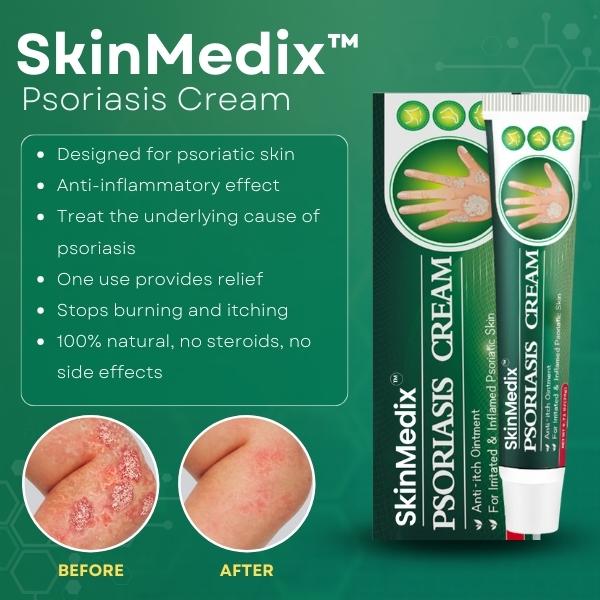 Psoriasis Treatment Cream | SkinMedix Psoriasis Cream | Deep Cleansing