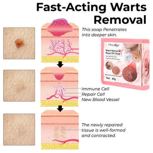 CC™ Wart Removal Rose Oil Soap