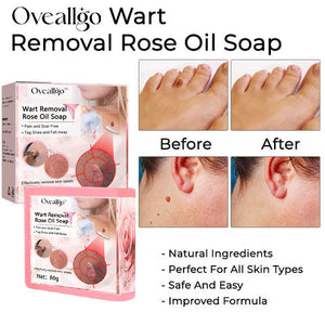 CC™ Wart Removal Rose Oil Soap