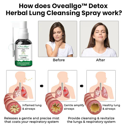 Herbal Detox Spray Cleansing Lung | Deep Cleansing