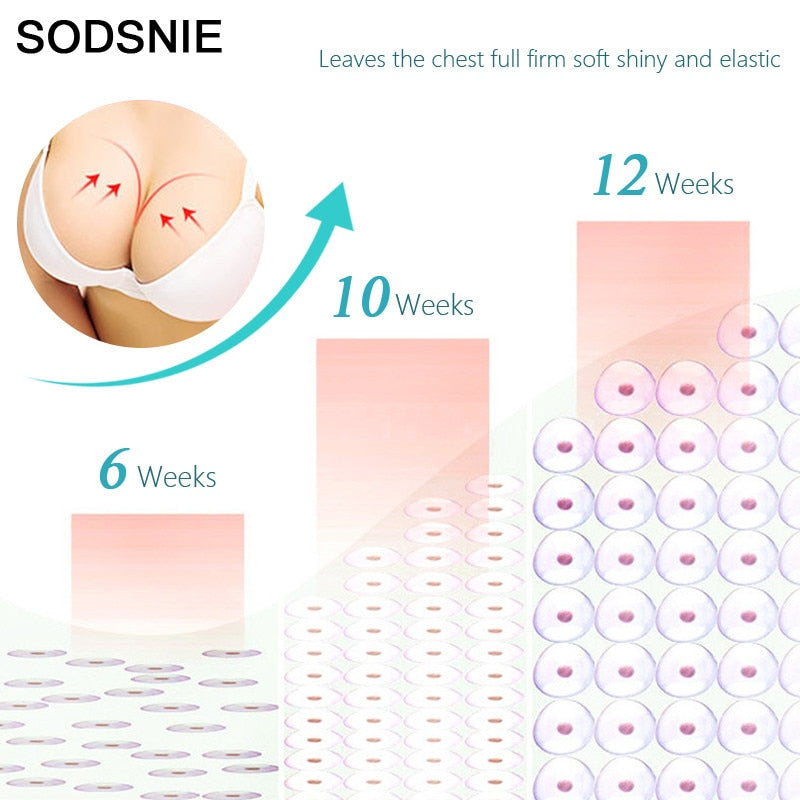 SODSNIE BREAST