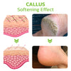 CC™ IHerbal Foot Callus And Corns Removal Soak