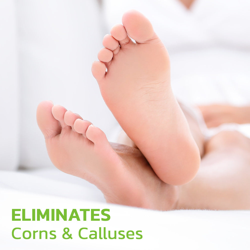 CC™ IHerbal Foot Callus And Corns Removal Soak