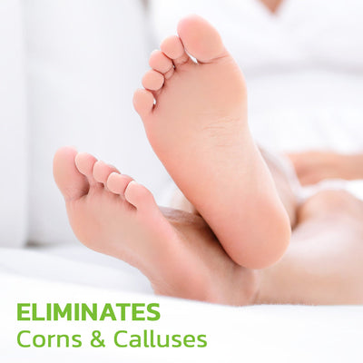 CC™ IHerbal Foot Callus And Corns Removal Soak