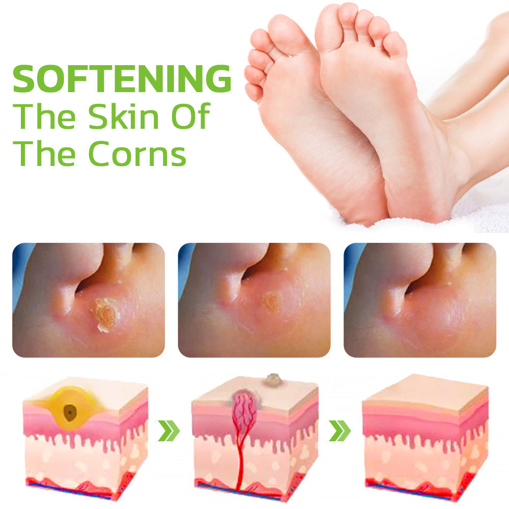 CC™ IHerbal Foot Callus And Corns Removal Soak