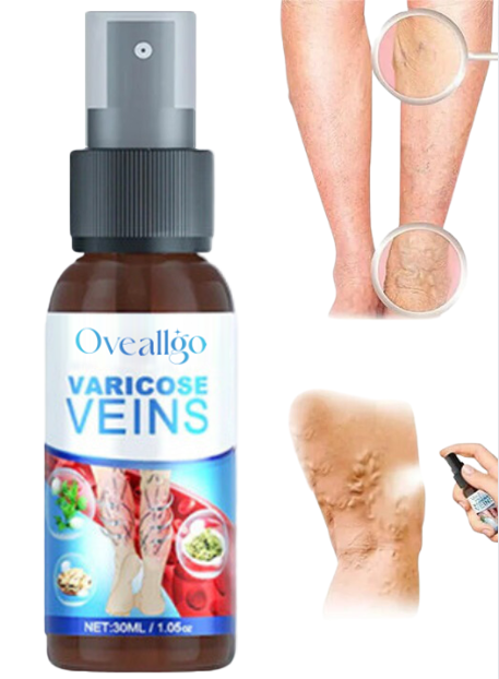 Oveallgo™ Varicose Veins Spray