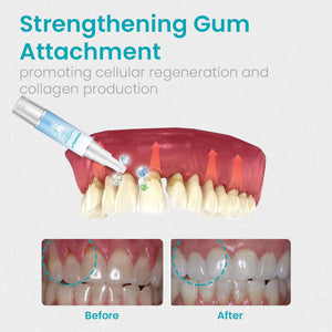 Ceoerty™ Gum Shield Therapy Gel