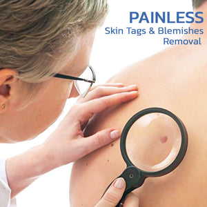 Skin Tag Remover Patch | Blemish Fast Treatment Patch | Deep Cleansing