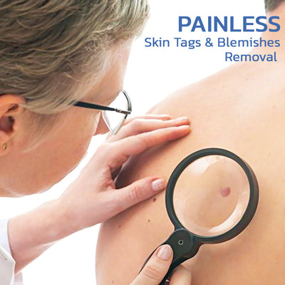 Skin Tag Remover Patch | Blemish Fast Treatment Patch | Deep Cleansing