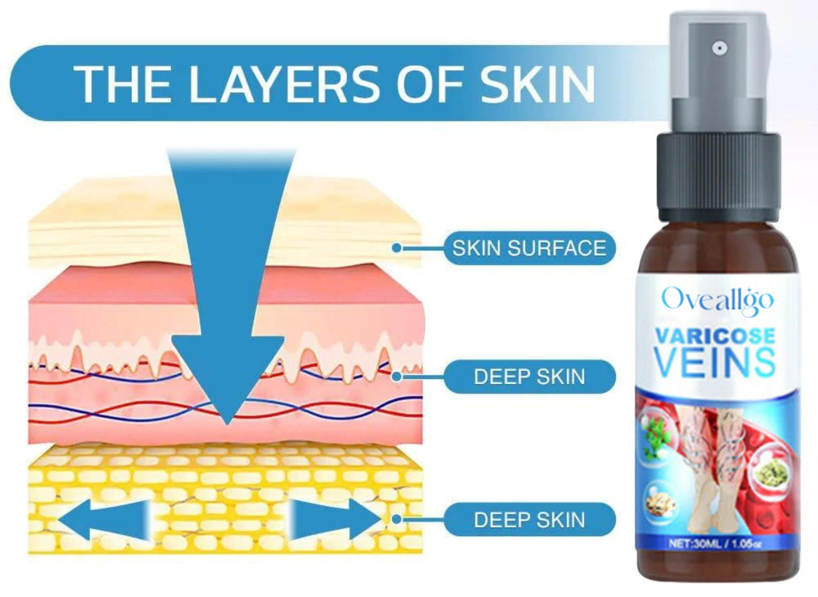 Oveallgo™ Varicose Veins Spray