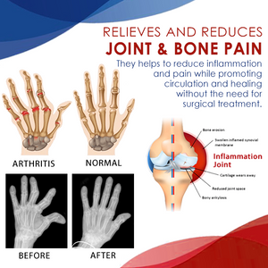 Joint & Bone Therapy Gel, Full Body Recovery, Plant Extract Formula