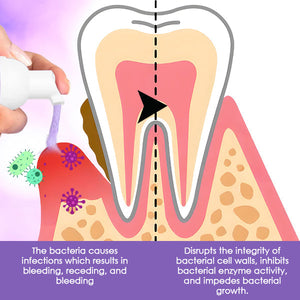 CC™ Gum Treatment Foam