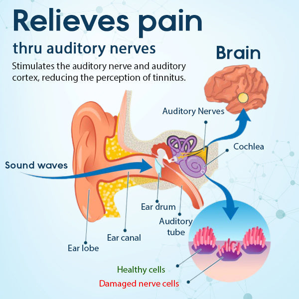 HearEase™ Tinnitus Relief Treatment Ear Patch