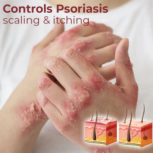 Kolmax™ Psoriasis Relief Spray