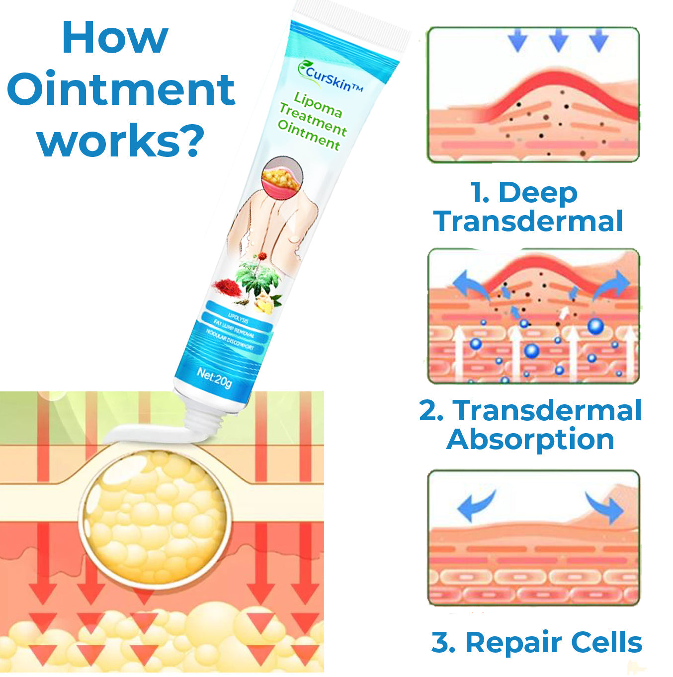 CurSkin™ Lipoma Treatment Ointment