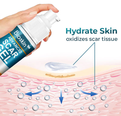 Scar Recovery Gel | Advanced Scar Removal Gel | Deep Cleansing