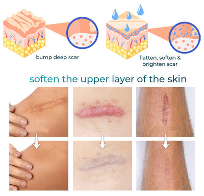 Scar Recovery Gel | Advanced Scar Removal Gel | Deep Cleansing