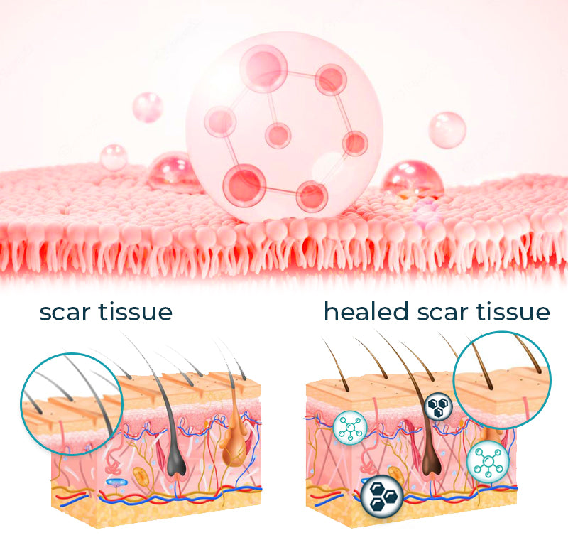 Scar Recovery Gel | Advanced Scar Removal Gel | Deep Cleansing