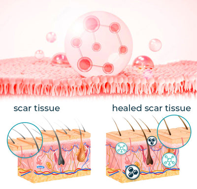 Scar Recovery Gel | Advanced Scar Removal Gel | Deep Cleansing