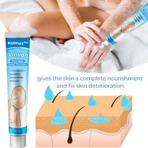 Kolmax™ Vitiligo Soothing Ointment