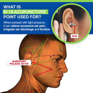 CC™ AcuPeace Tinnitus Relief Device